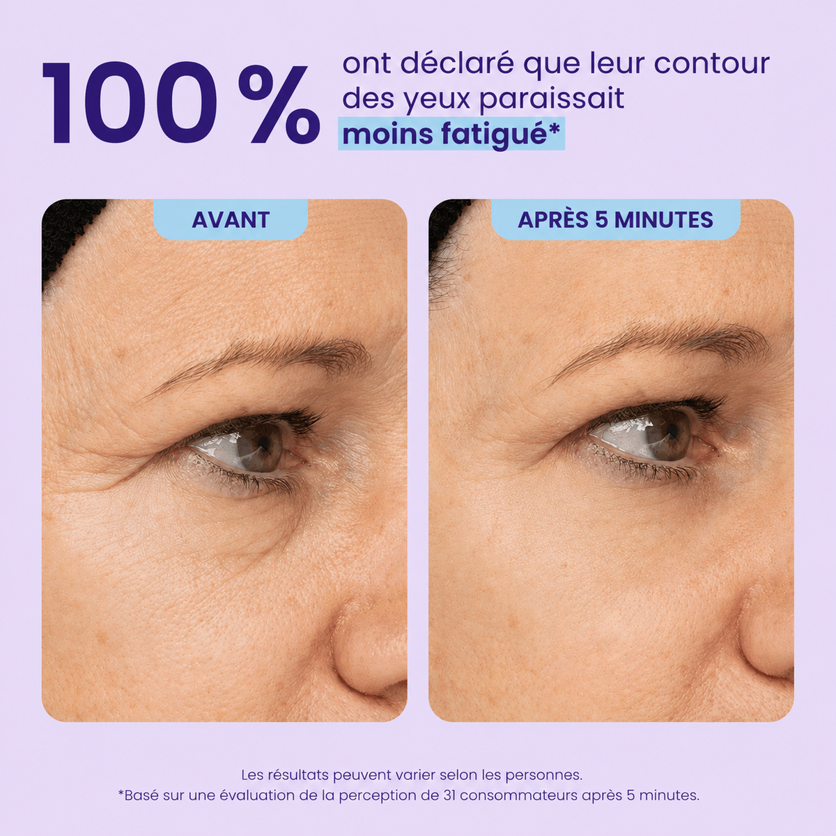 Gel Contour des Yeux Effet Liftant